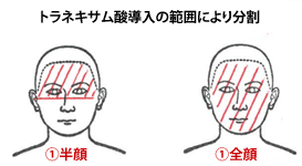 半顔と全顔